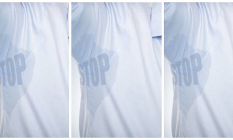 miraDry Sweating Sweat underarms armpit solution