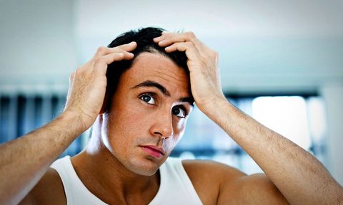 preventing hair loss, hair loss in men, balding, men's hair loss, preventing hair loss, mens hair products, hair loss prevention products