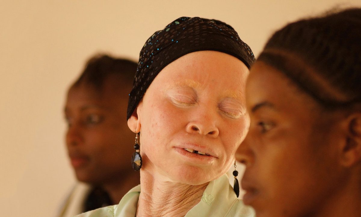 White African Power by Tanzania Albinism Collective