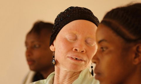 White African Power by Tanzania Albinism Collective
