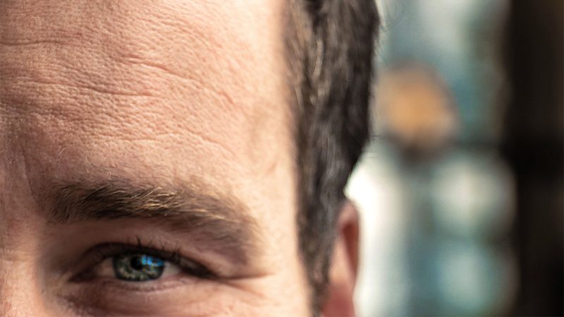 forehead wrinkles