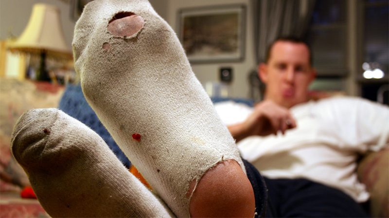 holey socks