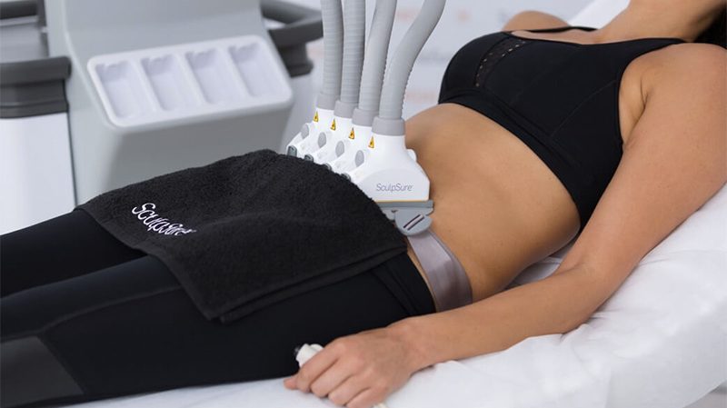 sculpsure
