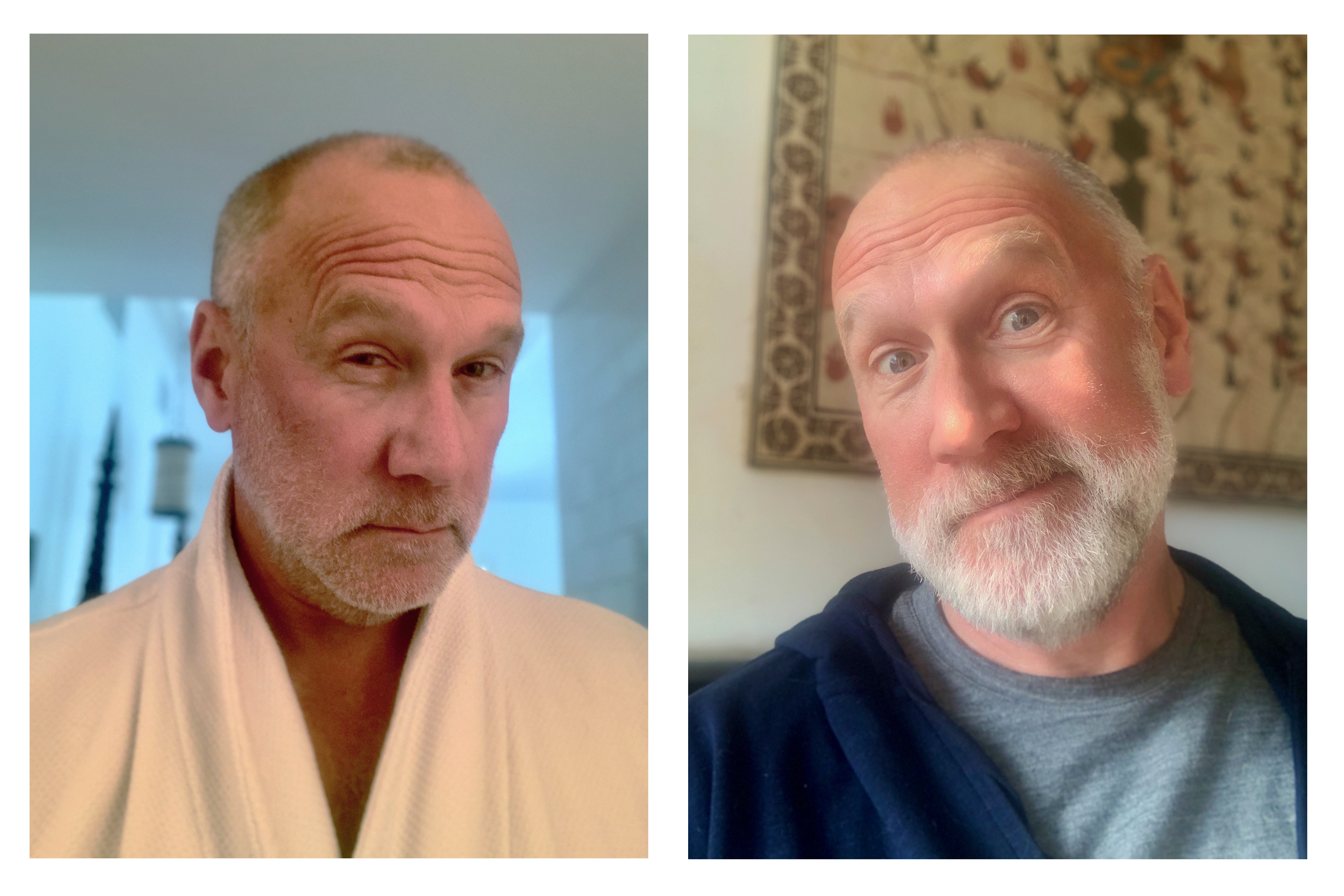 john jones before and after beard growth