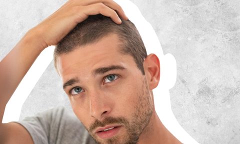 GLP-1 hair loss