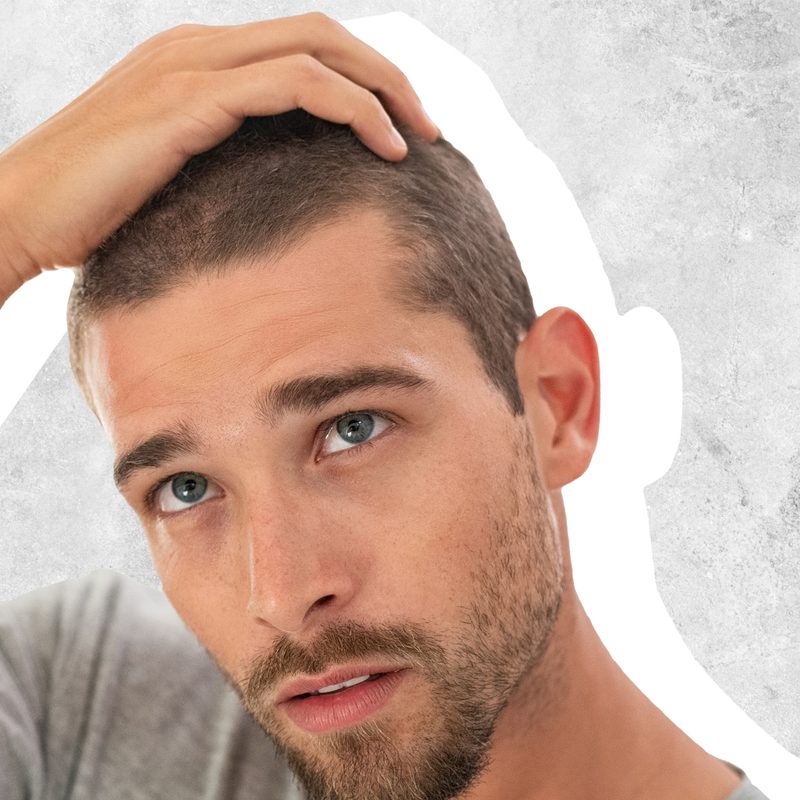 Man looking at hair loss
