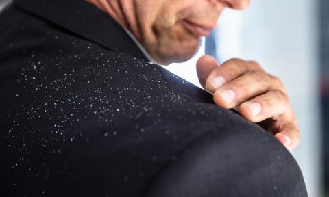 Businessman's hand brushing off fallen dandruff from shoulder