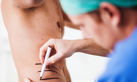 plastic surgery for men nurse sketching on patient