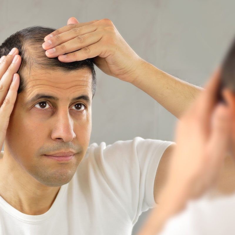 A man lookin at his thinning hair.