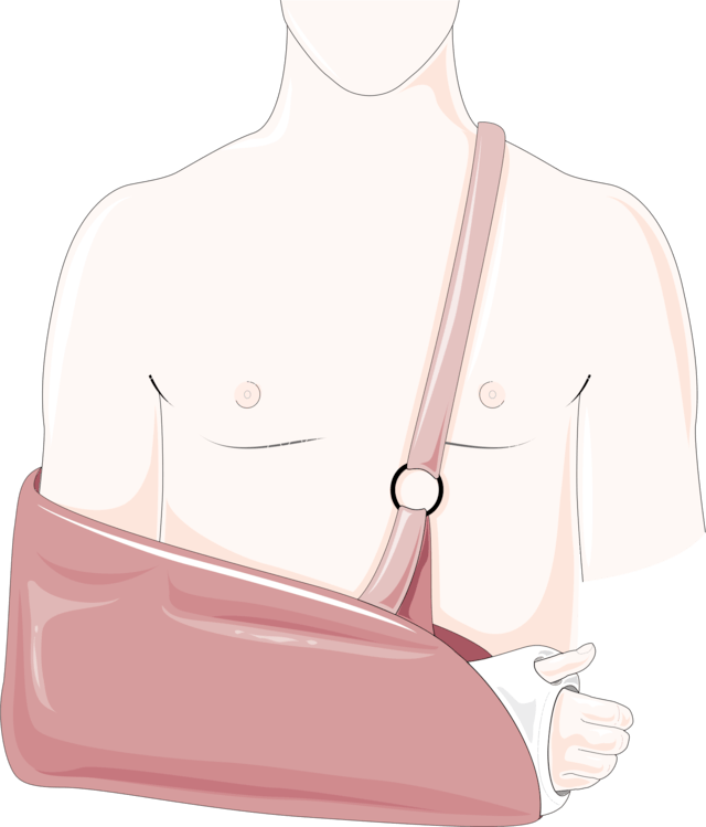 cartoon drawing of a shirtless man in an arm sling