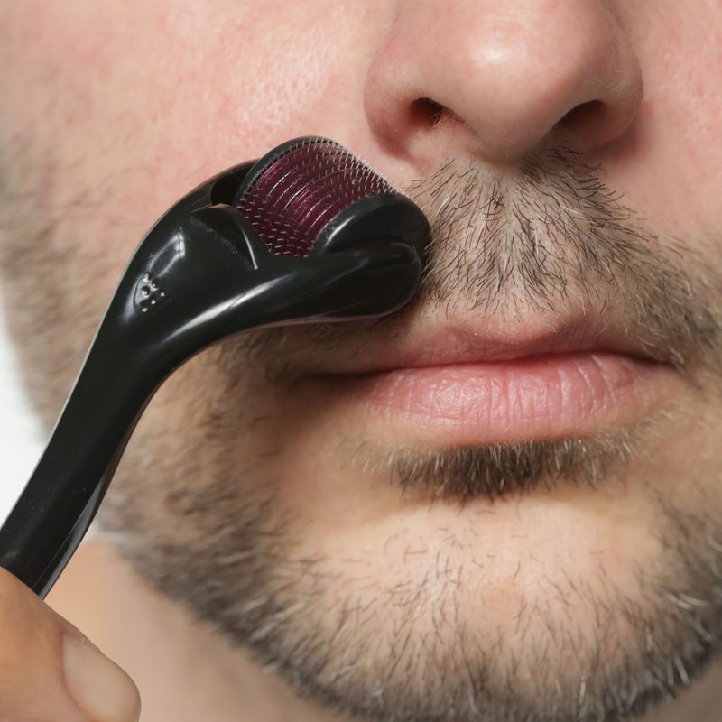Man using a micro needling tool.