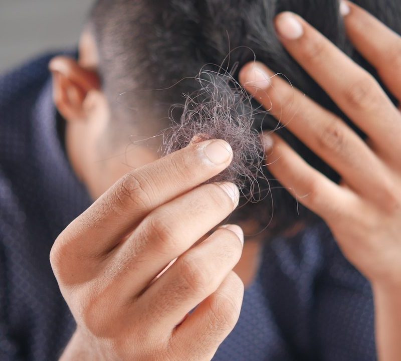 Man holding up hair that has fallen off