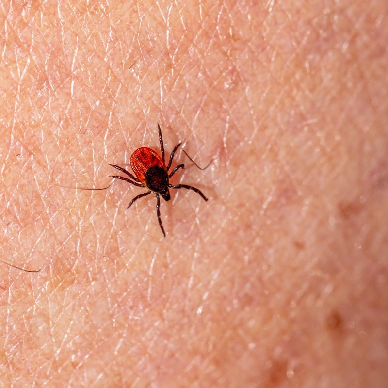 A tick hanging out on human skin