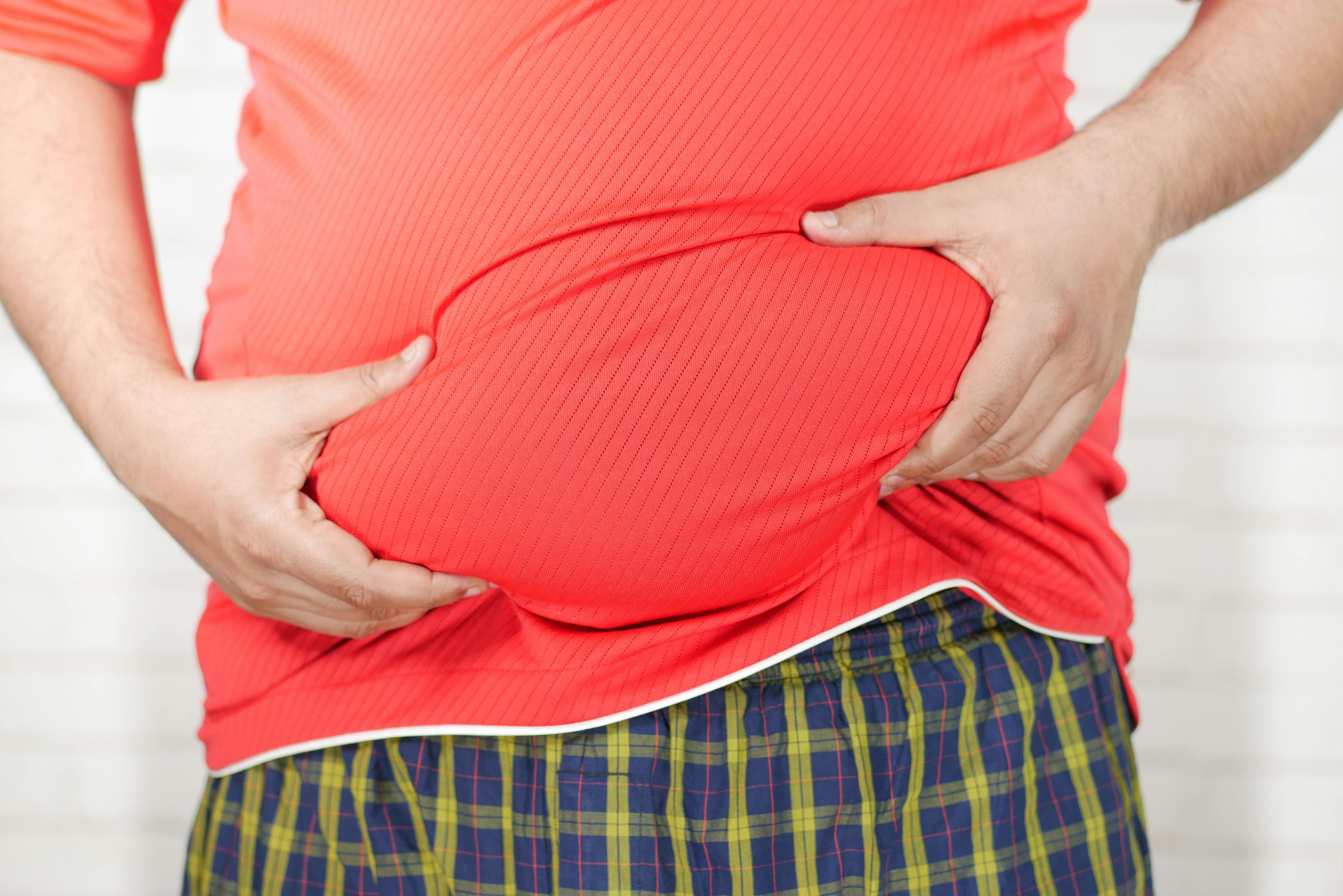 person who is bloated