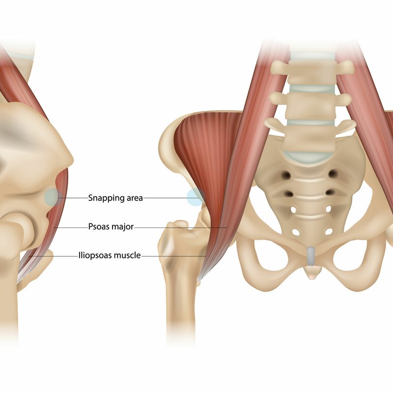 Hip flexors: Internal snapping hip syndrome. Psoas major, Iliopsoas muscle and snapping area