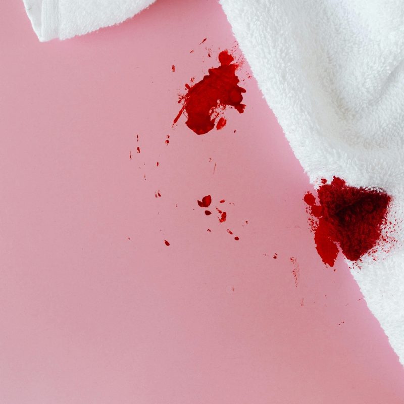 Stain on a towel