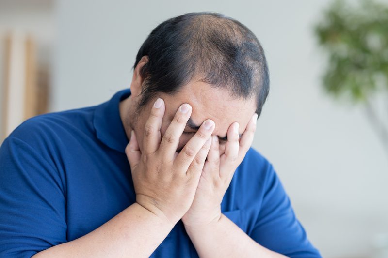 Hair loss products