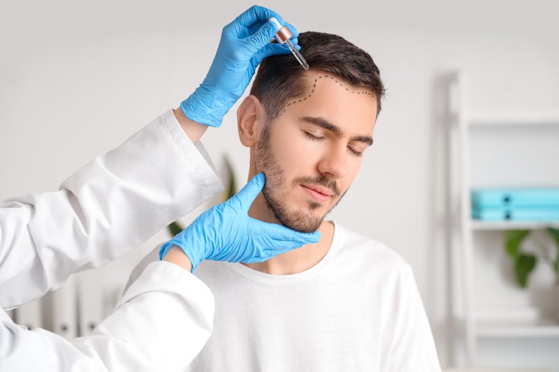Hair loss products