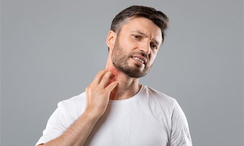 Reducing skin redness