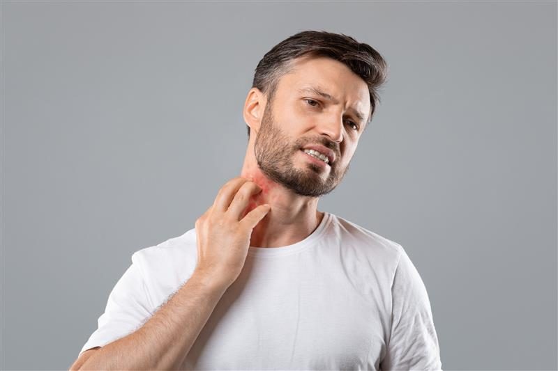 Reducing skin redness