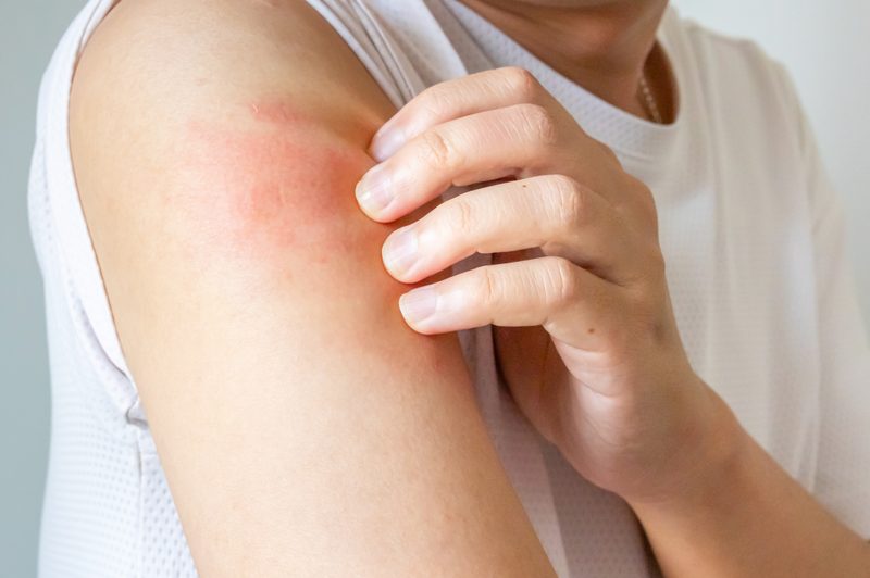 Reduce skin redness