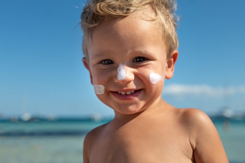 How to treat sunburn