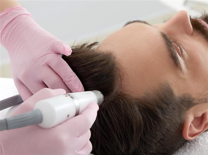 man laser hair treatment