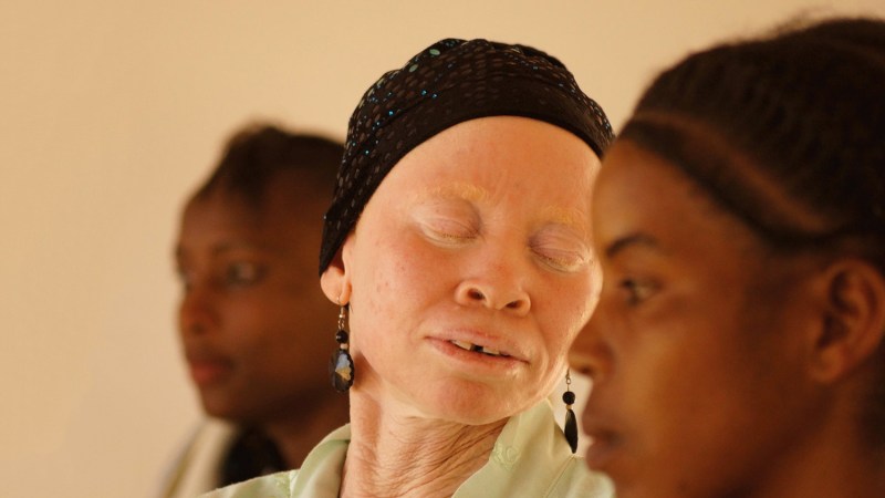 White African Power by Tanzania Albinism Collective