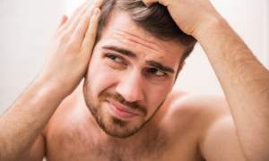 man looking at hair loss