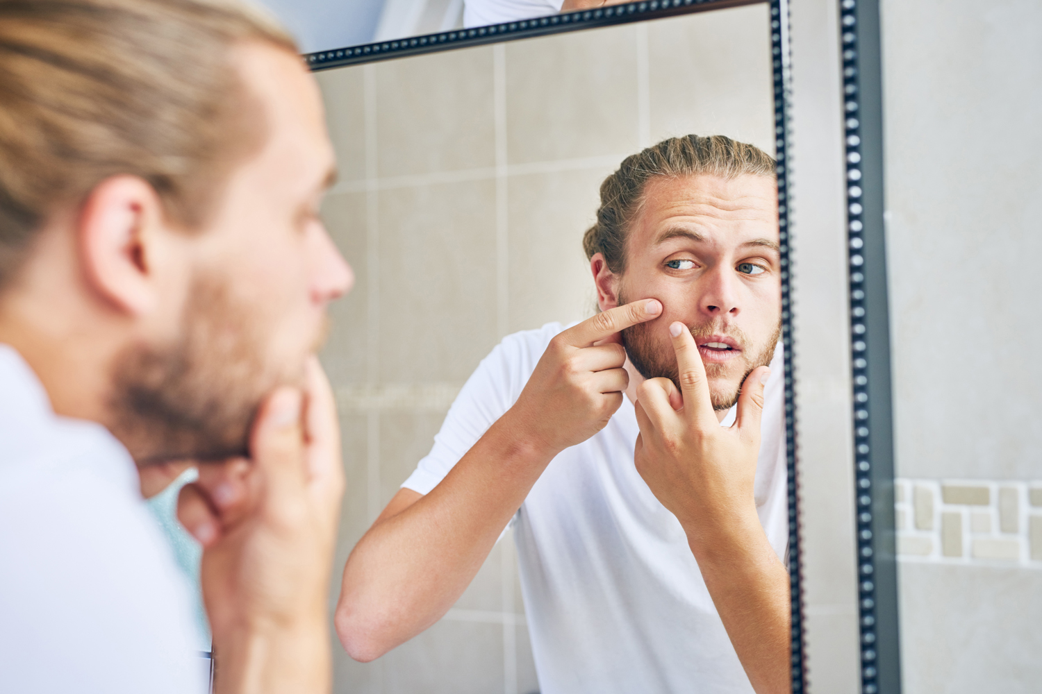Best acne treatment sales for men