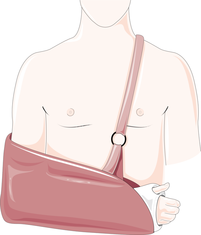 cartoon drawing of a shirtless man in an arm sling