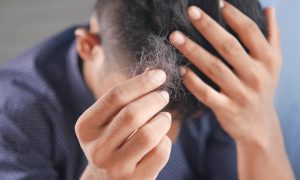 Man holding up hair that has fallen off