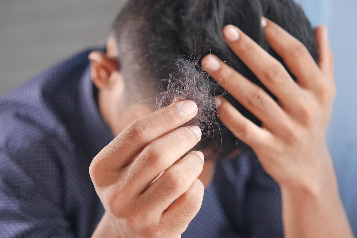 man holding up hair that has fallen off