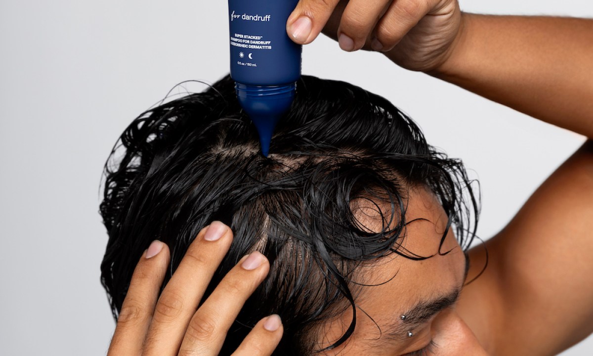 dandruff shampoo remedy 072624 2006 nm1