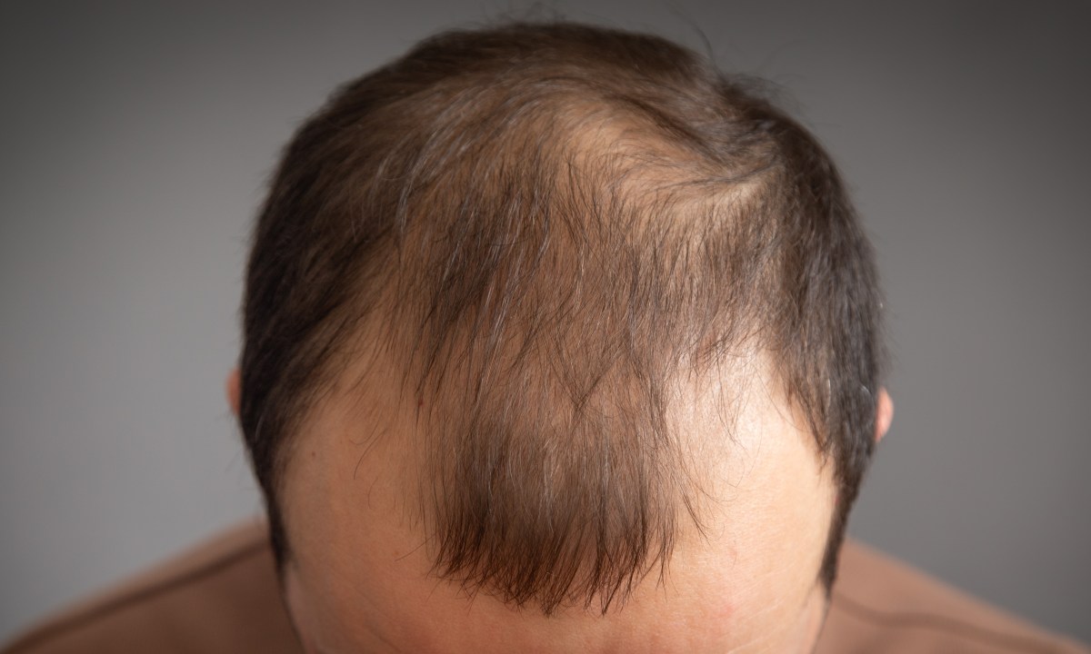 Haircuts for receding hairline