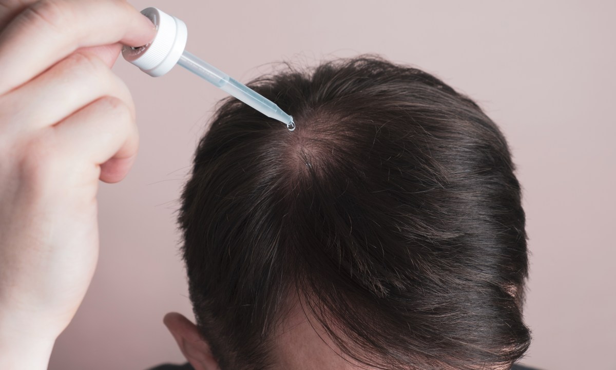 Hair loss products