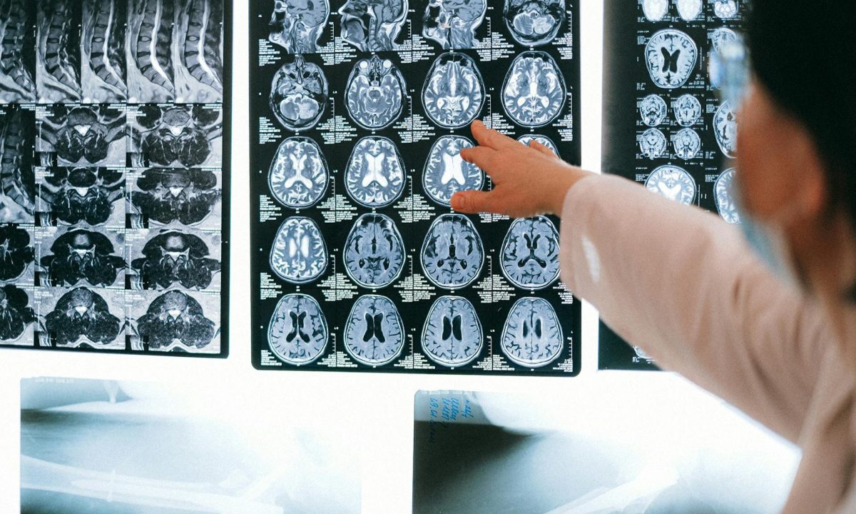 Brain scans